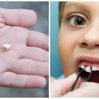 Why Parents should save their Child's Baby Teeth