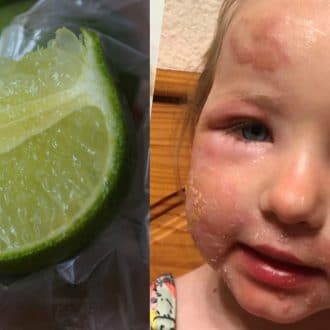 Margarita Burn Is a Thing And It's Absolutely Awful
