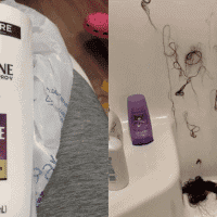 Wisconsin Woman Left Bald After Nair Was Put In Her Conditioner