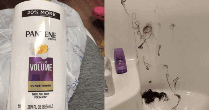 Wisconsin Woman Left Bald After Nair Was Put In Her Conditioner
