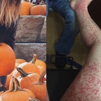 5 Hidden Dangers At the Pumpkin Patch
